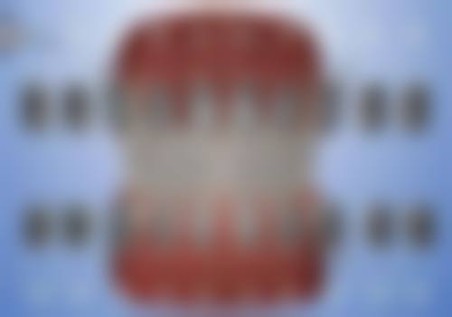 四、兴化财传口腔特色项目