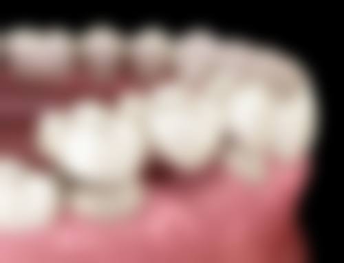六、北京佳美口腔贺帅军 医生口碑评价及真人实例反馈