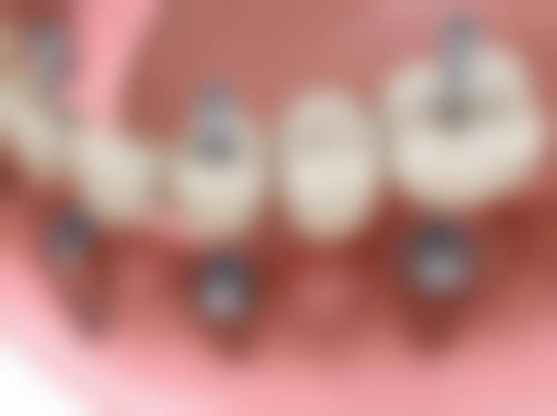 五、济南天桥天齿健口腔收费价格表