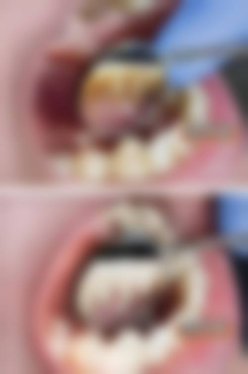 四、深圳如雅口腔诊所特色项目