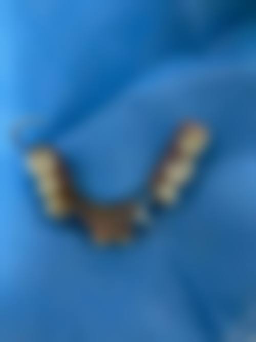 临床实例分享