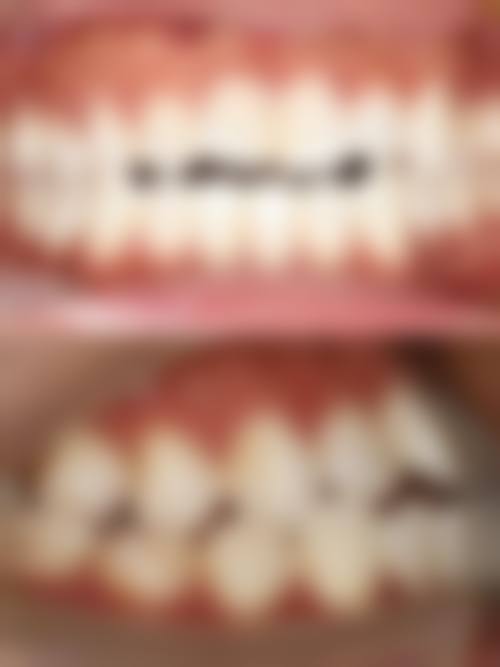 诊疗特色总结:朱馨岩医生的技术特点有哪些?