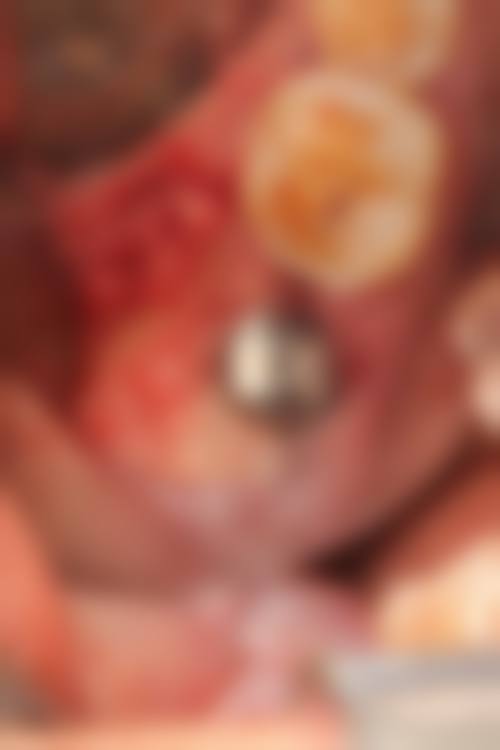 结语:选择灵誉口腔,开启自信笑容之旅