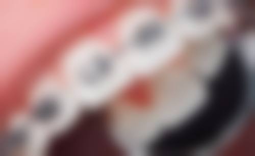 擅长项目详解深圳博耀蔡文颖口腔诊所向文