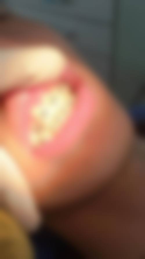 结尾预约号召深圳博耀蔡文颖口腔诊所向文