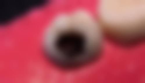 FAQ深圳博耀蔡文颖口腔诊所向文