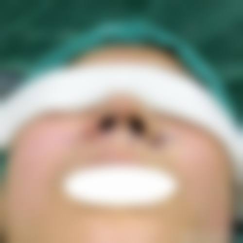 擅长项目详解西安医学校第二附属医院整形科