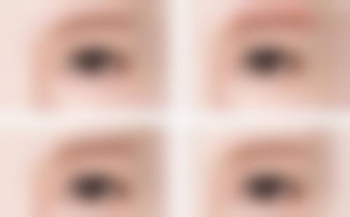 诊疗特色总结西安医学校第二附属医院整形科