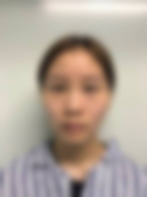 临床实例分享西安医学校第二附属医院整形科