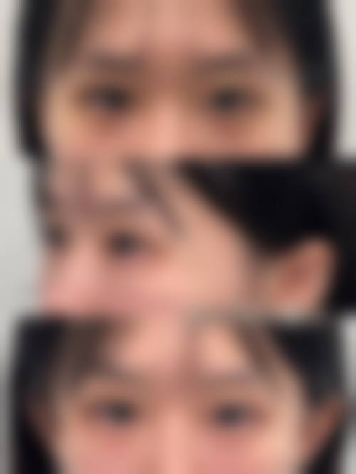 临床实例分享