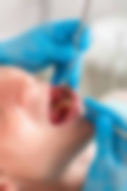 临床实例分享:真实见证治疗成效