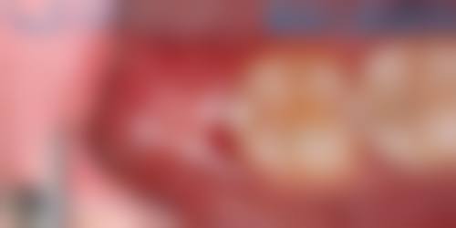 预约优惠活动:专属补贴助力健康