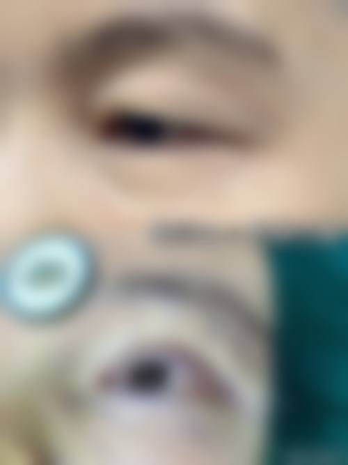 诊疗特色总结:常德市第二人民医院眼科胡晗