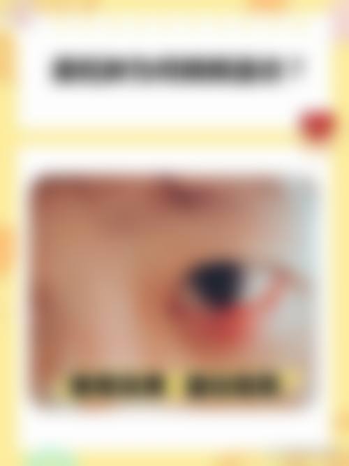 患者真实评价:常德市第二人民医院眼科胡晗
