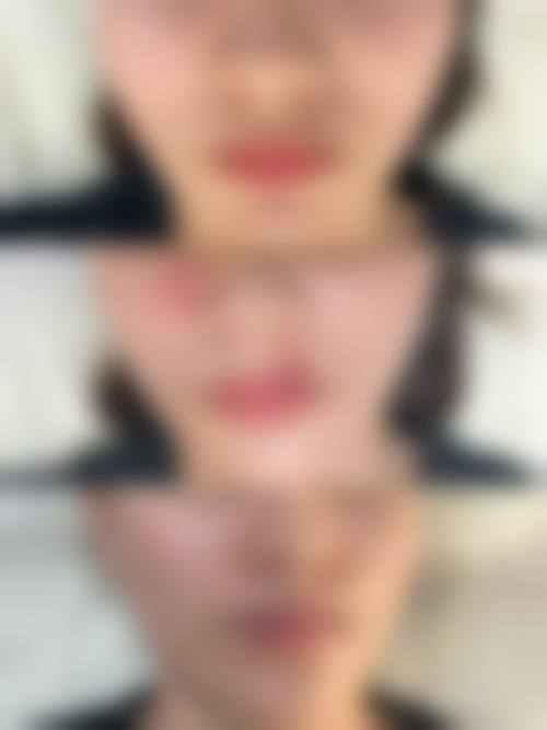 诊疗特色总结:徐根艳医生的风格有何不同?