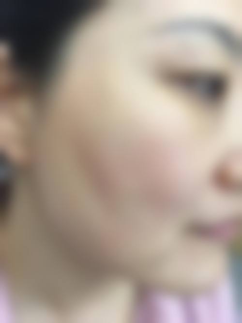 诊疗特色总结:济南瑞韩整形医疗美容单良
