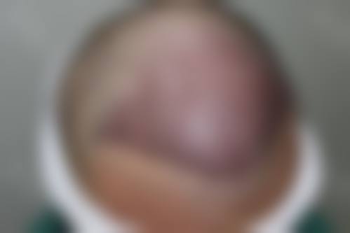 患者真实评价:大家是如何看待徐根艳医生的?