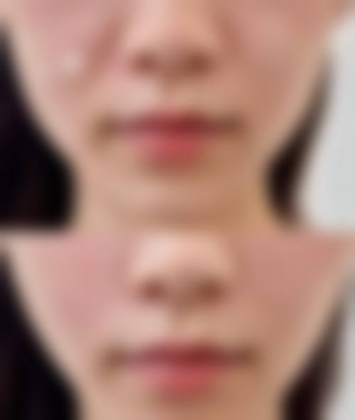 患者真实评价:济南瑞韩整形医疗美容单良