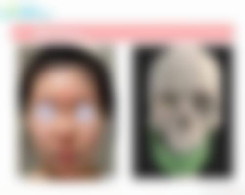FAQ:关于济南瑞韩整形医疗美容单良