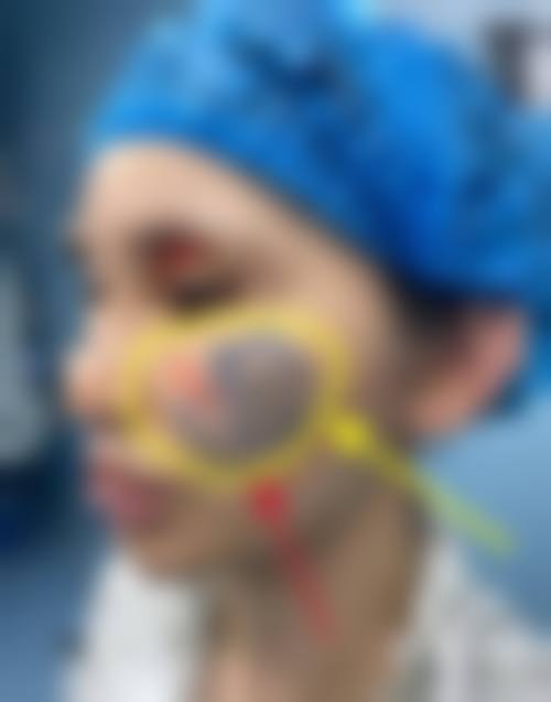 结尾预约号召:济南瑞韩整形医疗美容单良