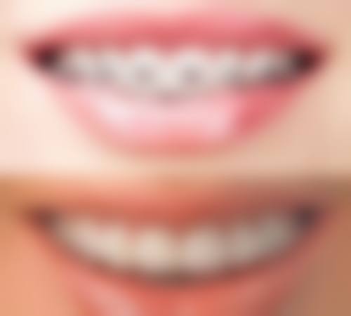 FAQ:常见问题解答