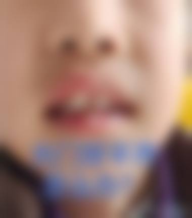 预约优惠活动:南京雨柏口腔门诊部张晓宁的专属补贴