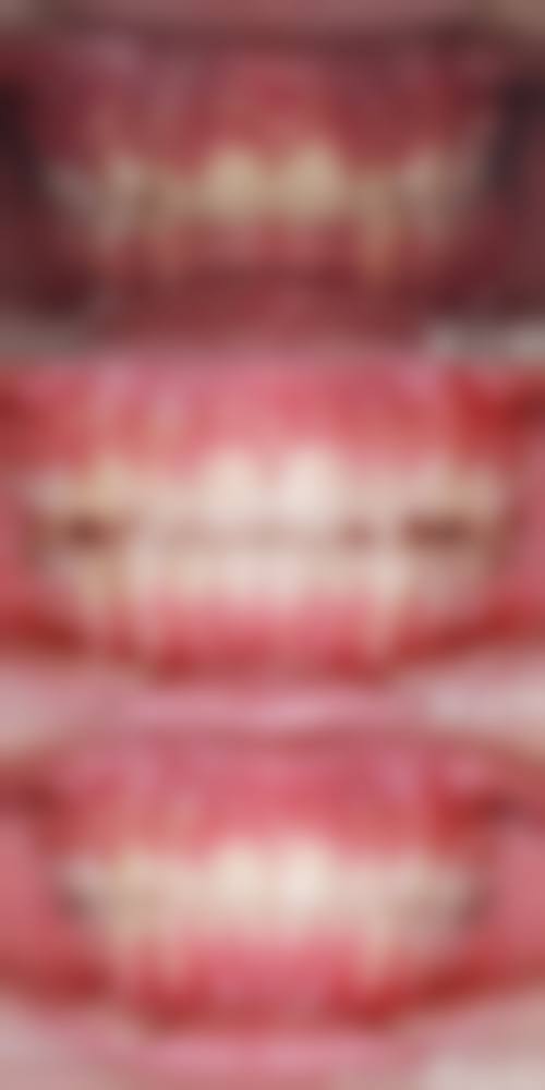 擅长项目详解:黄石大众口腔医院肖忠吉