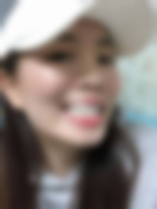 临床实例分享:南京雨柏口腔门诊部张晓宁的真实见证