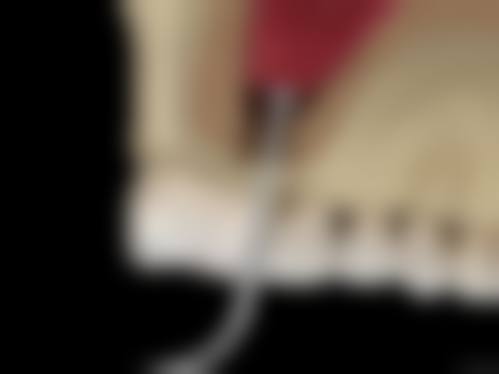 临床实例分享:真实治疗成效如何体现?