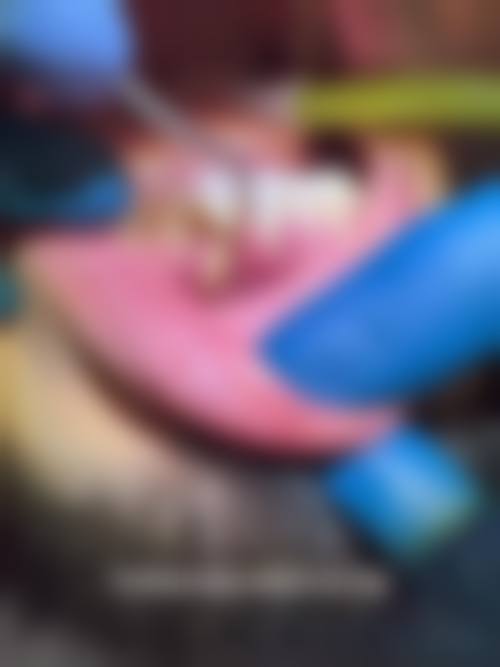 擅长项目详解:精细解决口腔难题