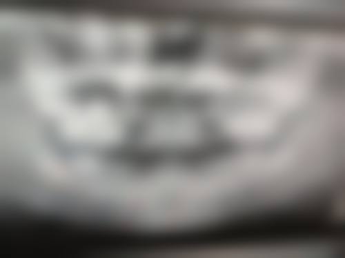 诊疗特色总结:为什么选择李康医生就诊?
