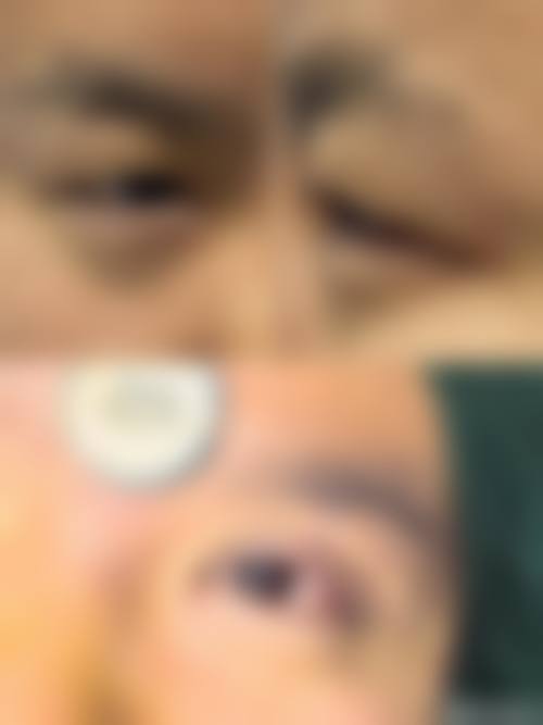 临床实例分享:治疗成效因人而异吗?