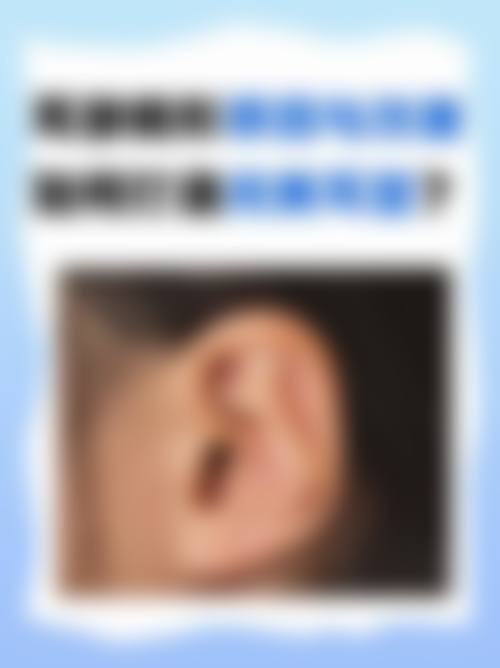 常见问题解答