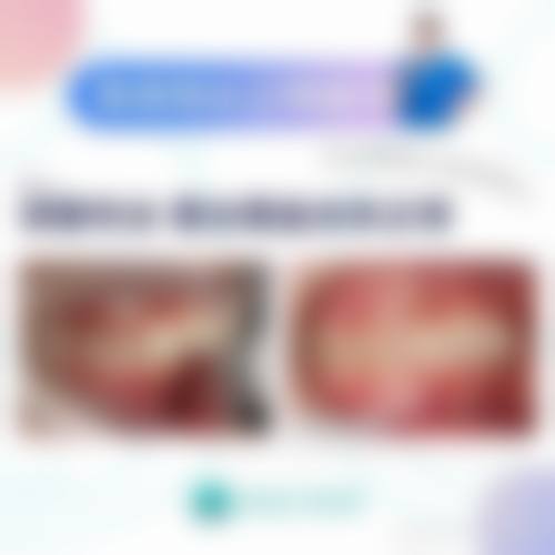 常见问题解答FAQ