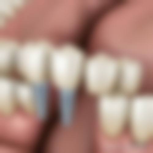高端设备与环境保护
