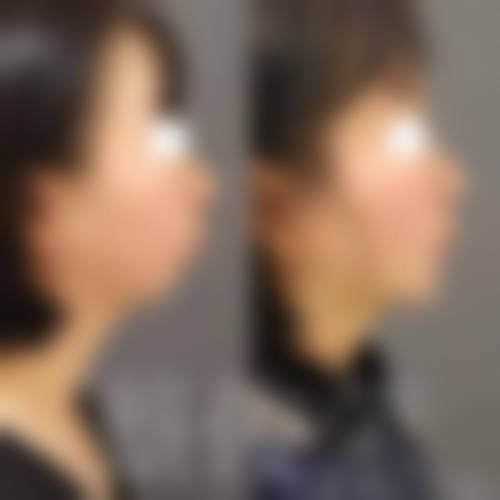 服务流程与优惠活动:贴心关怀助力蜕变