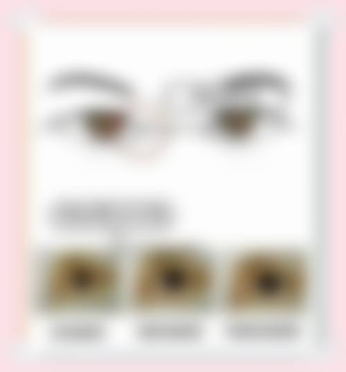 诊疗特色总结:鹤岗明仁眼科医院崔海滨医生优势分析