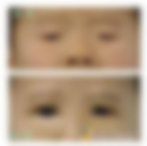 结尾预约号召：立即行动，拥抱清晰视界