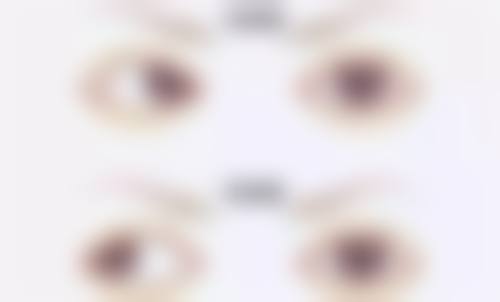 患者真实评价新乡医学校第三附属医院眼科