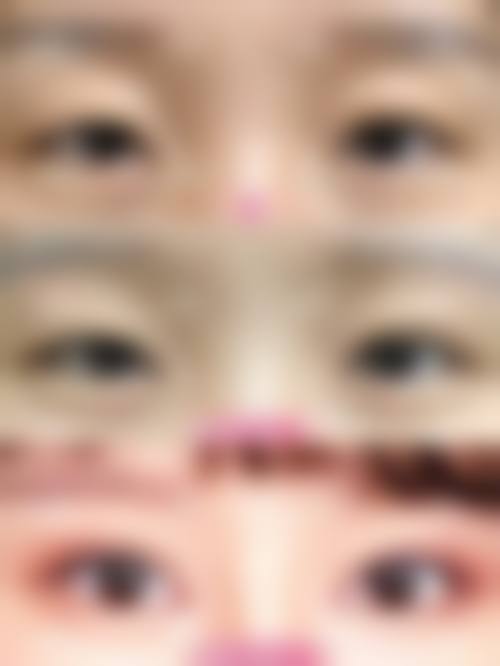引进前列设备与技术，精细解决皮肤难题