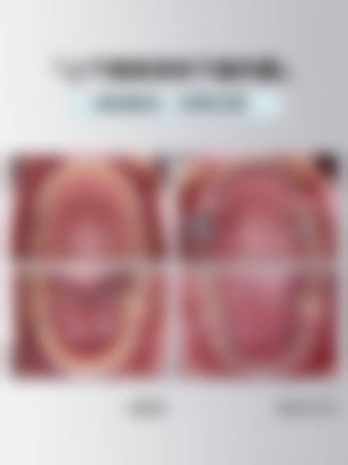 价格透明与优惠活动