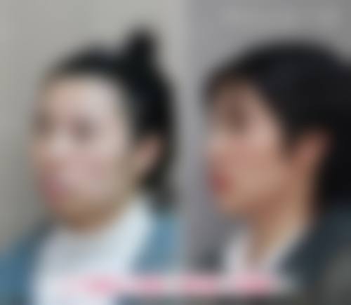 临床实例分享
