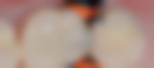 价格透明与优惠活动