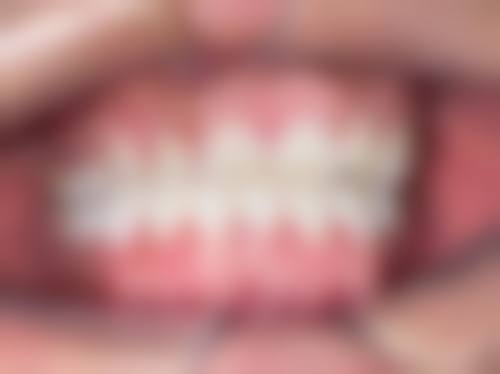 常见问题解答