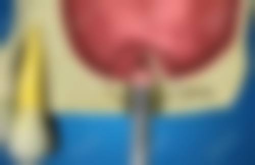 临床实例分享:重庆存济口腔医院赵敏