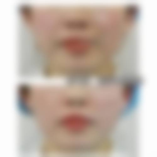 价格透明与预约指南：省心省钱变得更美