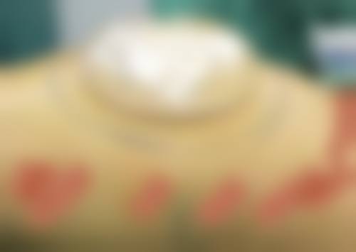 高端硬件加持：精细医疗设备提升疗效