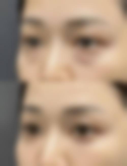 诊疗特色总结：为什么选侯俊医生？