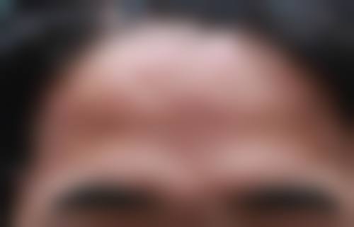 临床实例分享