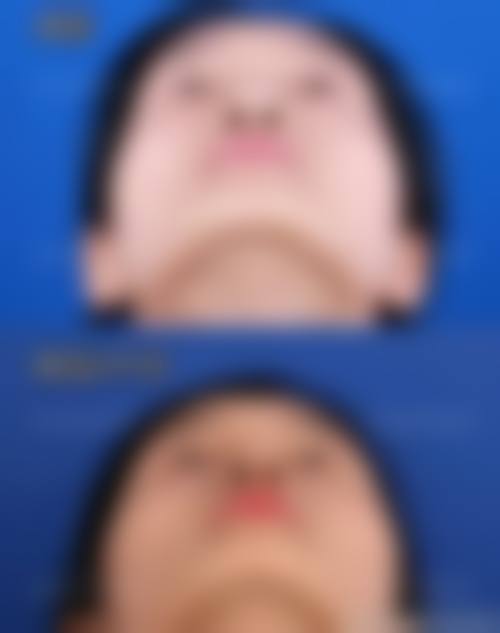 诊疗特色总结:高健医生的技术优势在哪里?